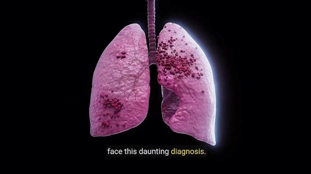 “MALADY 2 REMEDY” Week 2 Lungs