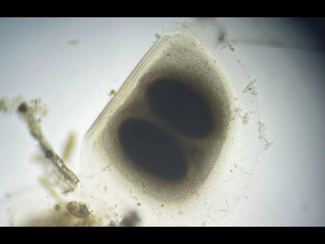 Nature Nugget: Microscopic Life