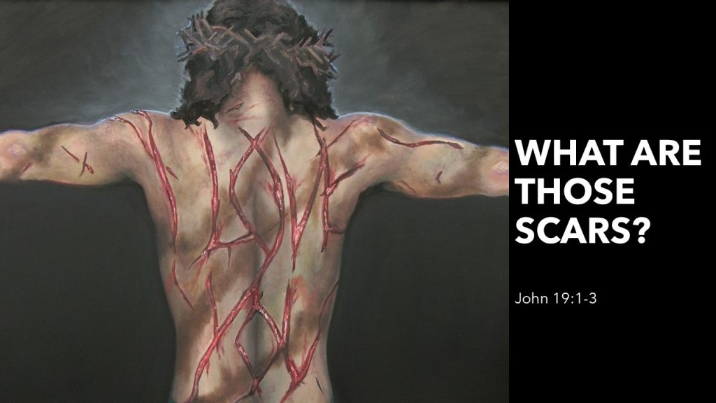 What Are Those Scars?